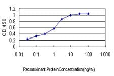Monoclonal Mouse anti-Human Acetyl-CoA Carboxylase / ACC Antibody (clone 6H5, WB)