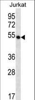 DCAF12 / WDR40A Antibody (aa223-252)