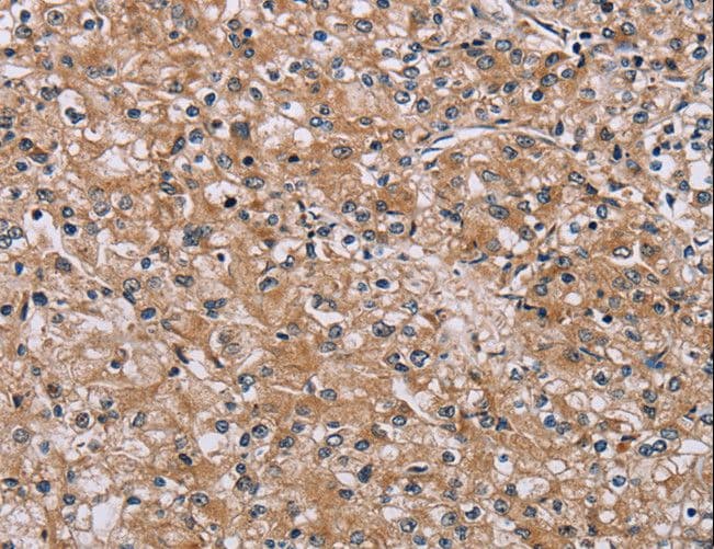 Polyclonal Rabbit anti-Human POMT1 Antibody (IHC)