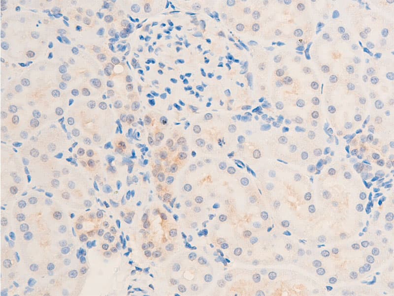 TGFB1 / TGF Beta 1 Antibody
