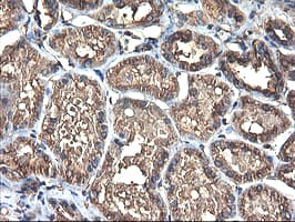 TUBAL3 Antibody (aa150-446, clone OTI2F6, Carrier-free)