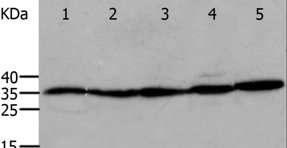 ANXA5 / Annexin V Antibody