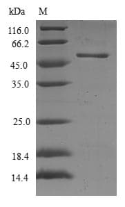 Human RAB17 Protein (Recombinant GST, N-terminus)