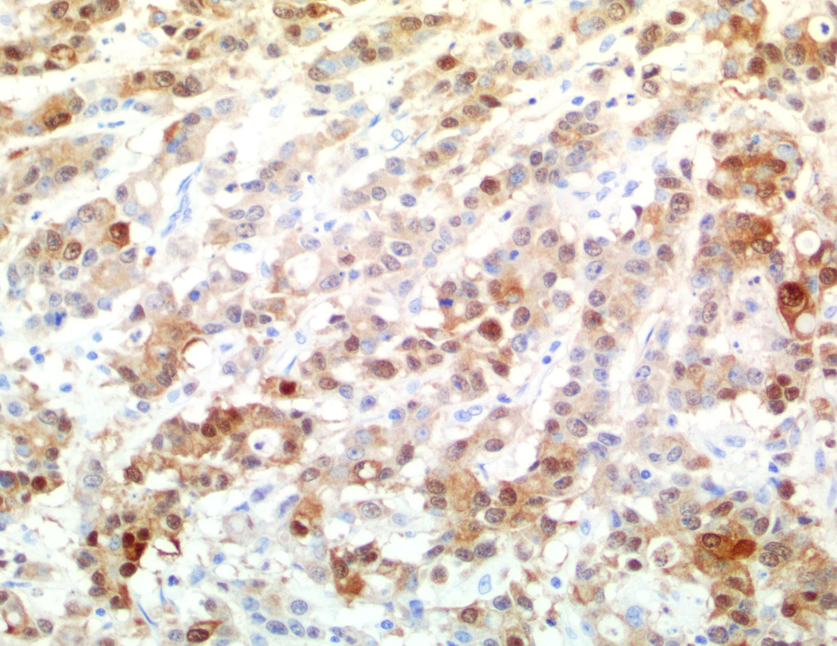 Monoclonal Mouse anti-Human S100P Antibody (clone UMAB24, IHC, IF, WB)