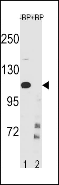 Polyclonal Rabbit anti-Human IKBKB / IKK2 / IKK Beta Antibody (aa587-615, WB)