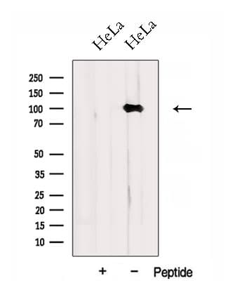 Polyclonal Rabbit anti-Human DNM2 / Dynamin-2 Antibody (WB)