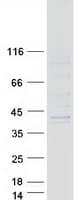 Human SGCG / Gamma-Sarcoglycan Protein (Recombinant Myc-DDK (Flag))