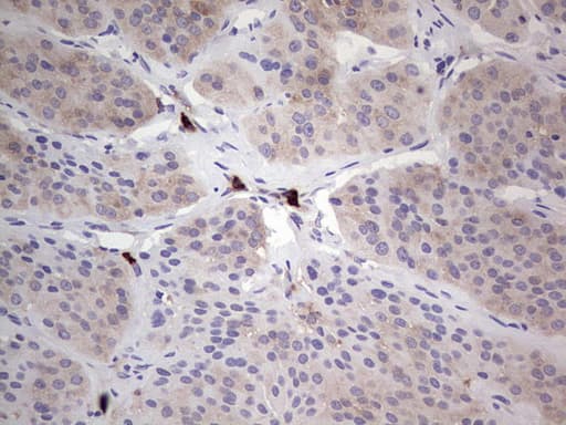 Monoclonal Mouse anti-Human PKM2 Antibody (clone 11B11, IHC, WB)