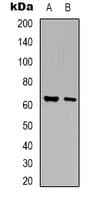 ARSG / Arylsulfatase G Antibody (Internal)