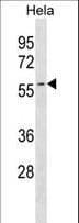 AUP1 Antibody (aa440-468)