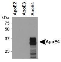 Monoclonal Mouse anti-Human APOE / Apolipoprotein E Antibody (clone 4E4, Biotin, aa100-150, IHC, WB)