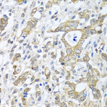 Polyclonal Rabbit anti-Human TICAM1 / TRIF Antibody (IHC, WB)