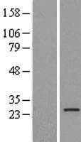 MRPL16 Protein (Over-Expression Lysate Myc-DDK (Flag))