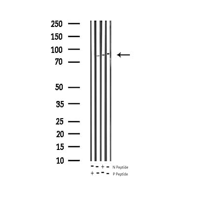 STAT5A Antibody (phospho-Tyr694)