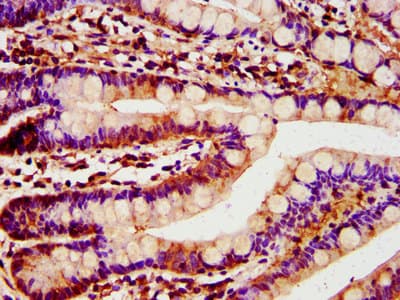 Polyclonal Rabbit anti-Human Rhodanese / TST Antibody (IHC, WB)