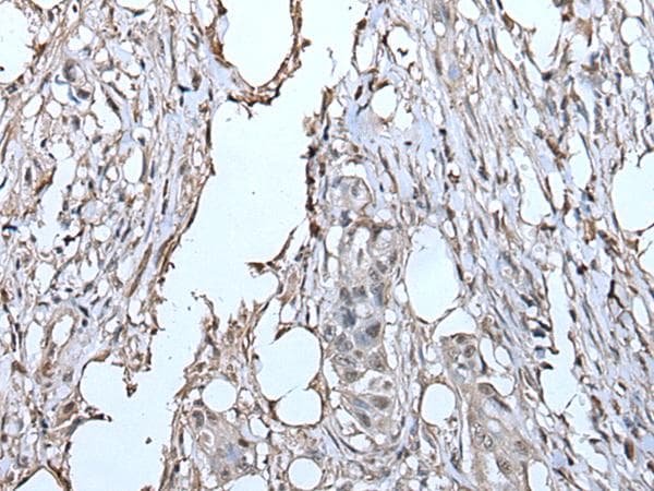 TPT1 / TCTP Antibody
