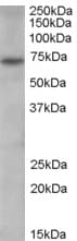 IHC-plus™ PADI4 / PAD4 Antibody (aa2-14)