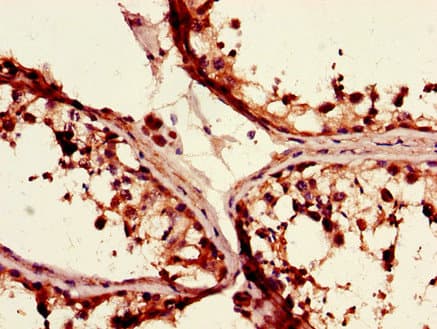 Polyclonal Rabbit anti-Human TGIF1 Antibody (IHC, IF, WB)