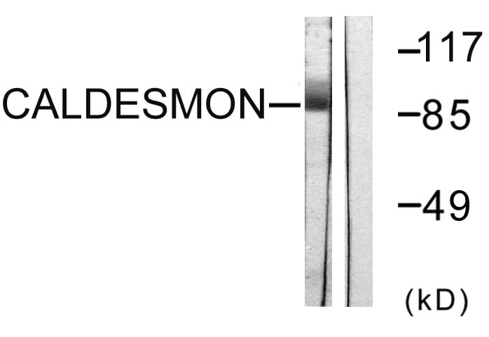 Polyclonal Rabbit anti-Human CALD1 / Caldesmon Antibody (aa744-793, IHC, IF, WB)