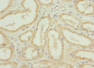 Polyclonal Rabbit anti-Human NRN1L Antibody
