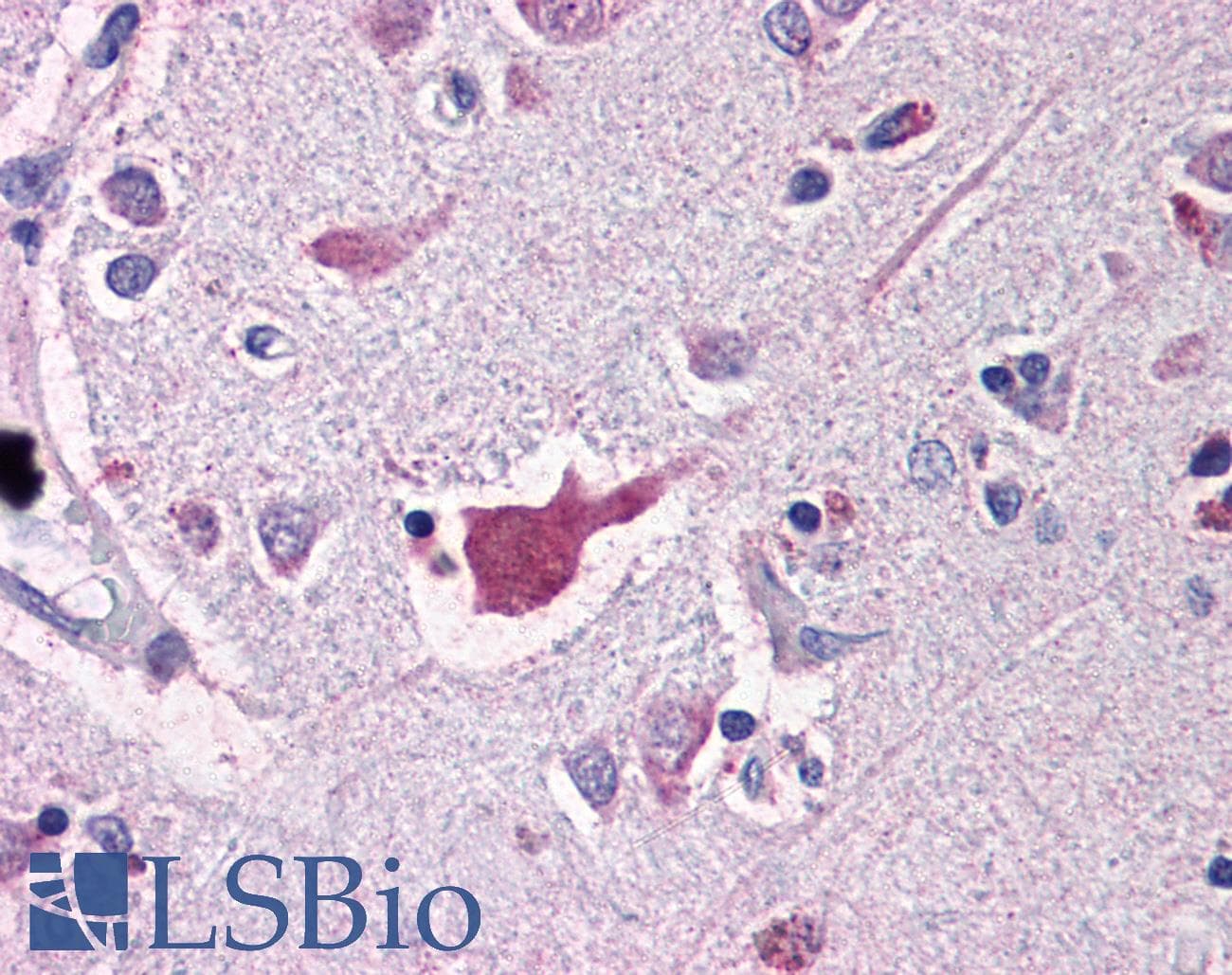 IHC-plus™ Polyclonal Rabbit anti-Human NLRP2 / NALP2 Antibody (IHC, WB)