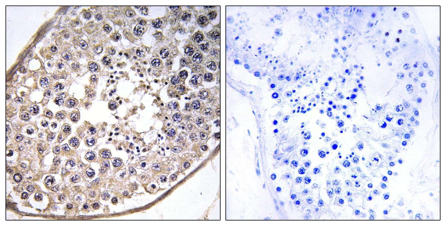 DNAL4 / Dynein Light Chain 4 Antibody