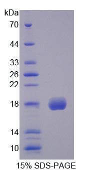 Human Properdin / CFP Protein (Recombinant His-T7)