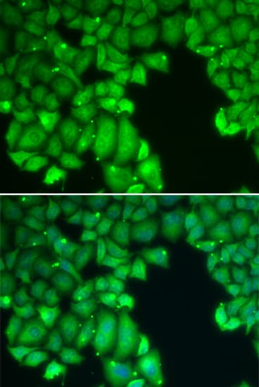 PathPlus™ CASP10 / Caspase 10 Antibody