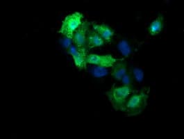 MAP2K3 / MEK3 / MKK3 Antibody (clone OTI5D7)