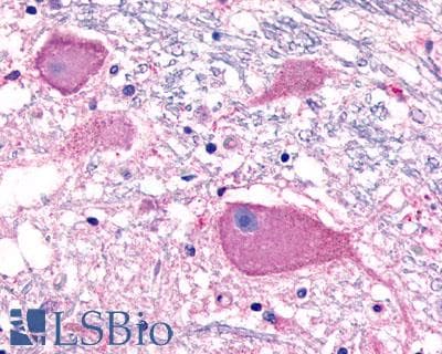 PathPlus™ Polyclonal Rabbit anti-Human ADGRB3 / BAI3 Antibody (Cytoplasmic Domain, IHC)