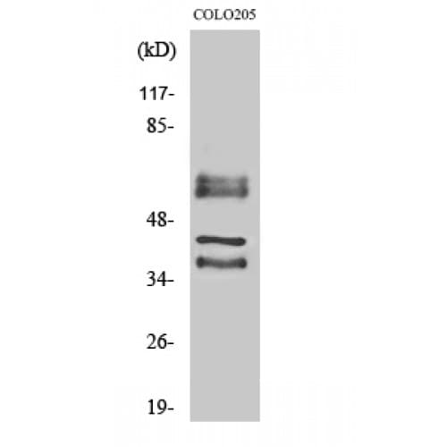 Polyclonal Rabbit anti-Human PPHLN1 Antibody (40-120 aa, Internal, IHC, WB)
