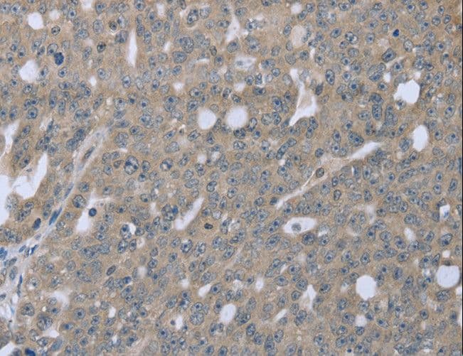 Polyclonal Rabbit anti-Human ETK / BMX Antibody (IHC)