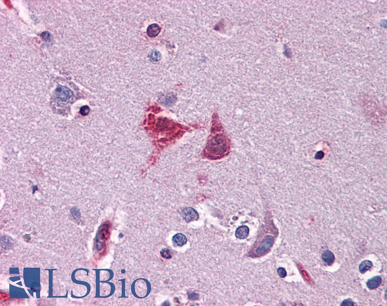 IHC-plus™ WDR20 Antibody (clone 2A6)