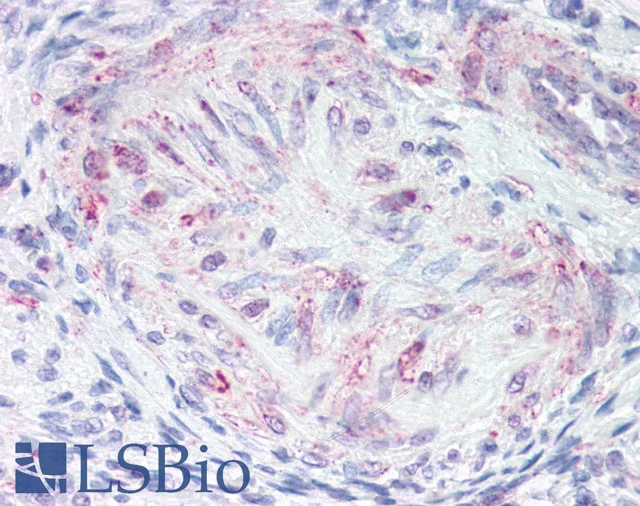 IHC-plus™ Polyclonal Rabbit anti-Human MLNR/GPR38/Motilin Receptor Antibody (C-Terminus, IHC)
