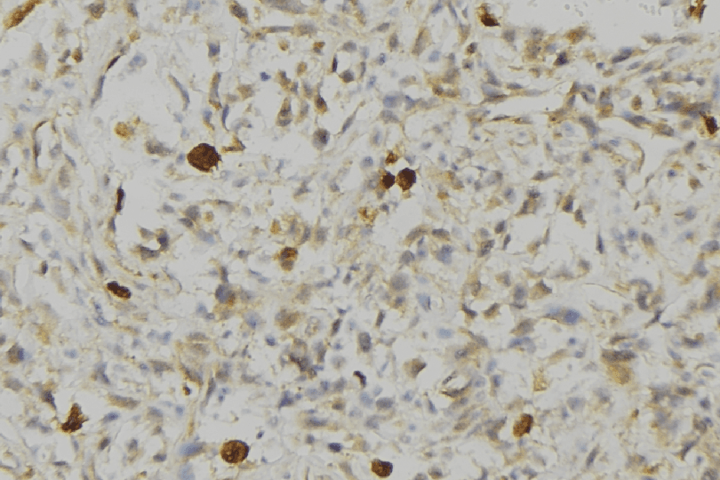 Polyclonal Rabbit anti-Human HLA-DRA Antibody (IHC, IF, WB)
