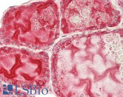 IHC-plus™ CALR / Calreticulin Antibody (aa 18-417)