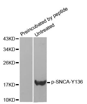 SNCA / Alpha-Synuclein Antibody (phospho-Tyr136)