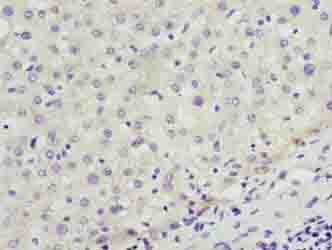 IHC-plus™ ENOX1 / CNOX Antibody