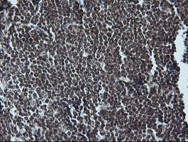 Monoclonal Mouse anti-Human MAPK3 / ERK1 Antibody (clone OTI4D7, IHC, IF, WB)