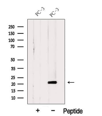 C11orf73 Antibody