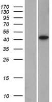 DPS / PDSS1 Protein (Over-Expression Lysate Myc-DDK (Flag))
