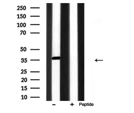 Polyclonal Rabbit anti-Human ANXA1 / Annexin A1 Antibody (IHC, WB)