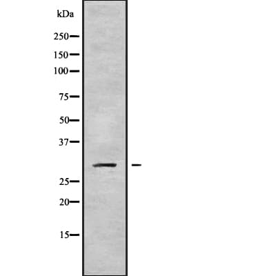 RPS4Y2 Antibody