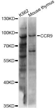 Polyclonal Rabbit anti-Human CCR9 / CD199 Antibody (WB)