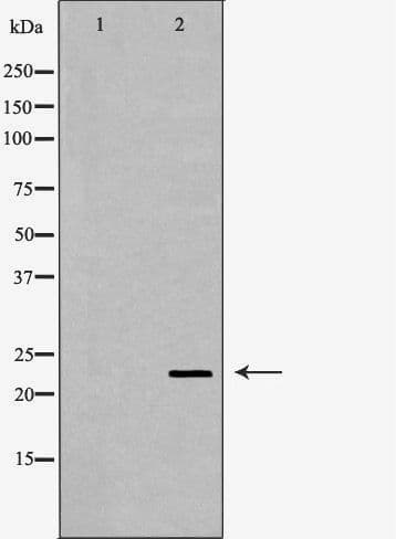 CRYBB2 Antibody
