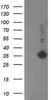 SIRT5 / Sirtuin 5 Antibody (clone OTI2E10)