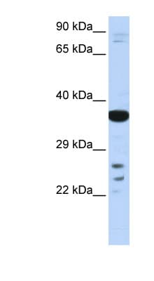Polyclonal Rabbit anti-Human VSX1 Antibody (aa108-157, WB)