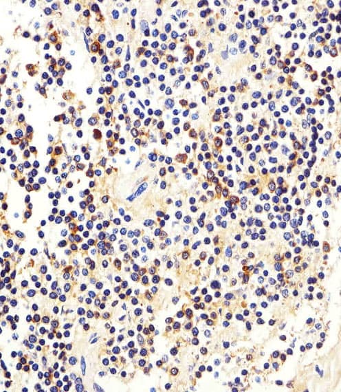 Polyclonal Rabbit anti-Human MME / CD10 Antibody (aa99-132, IHC, WB)