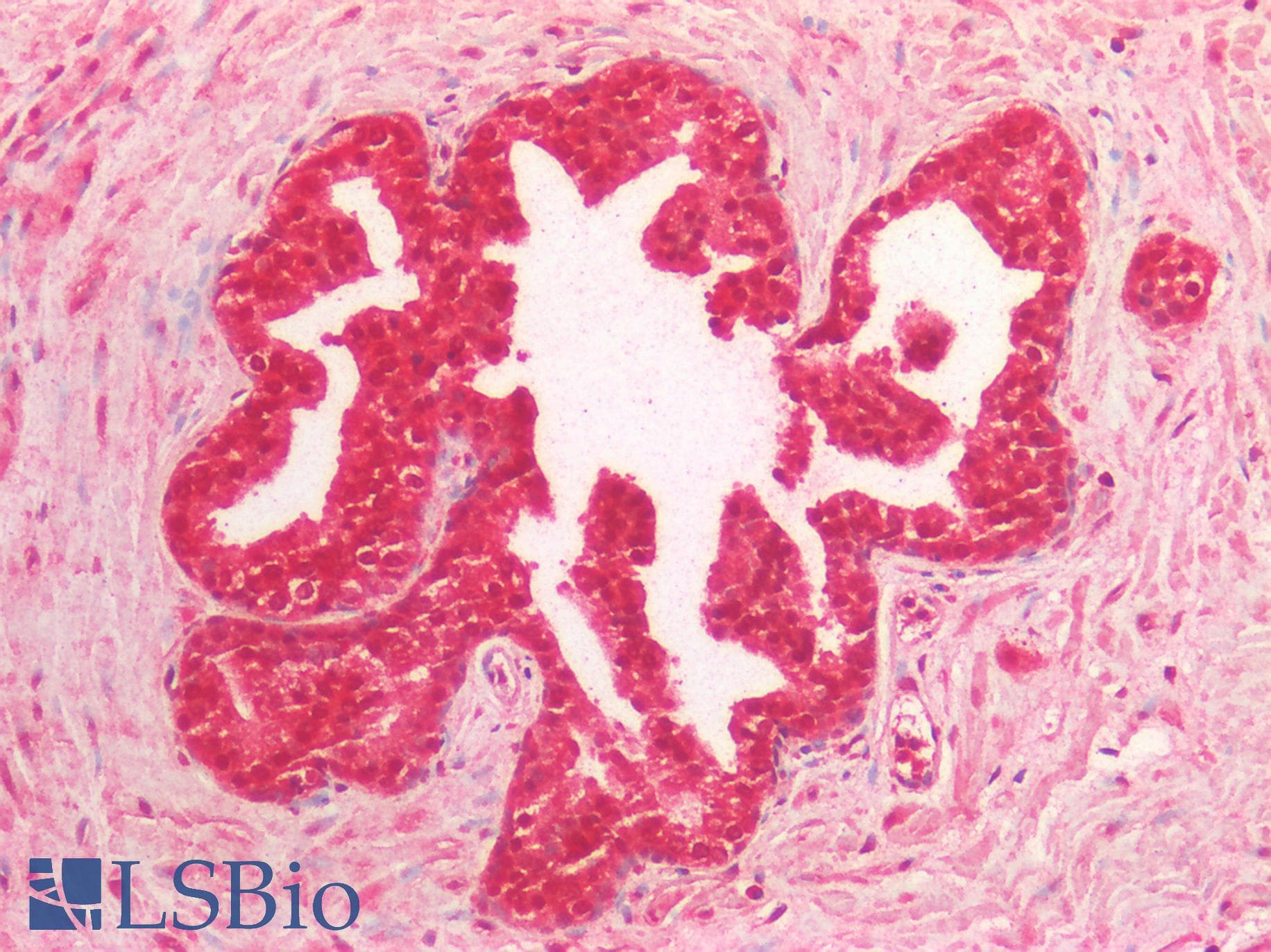 IHC-plus™ MYC / c-Myc Antibody