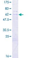 Human SLC25A43 Protein (Recombinant GST)
